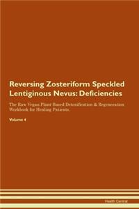 Reversing Zosteriform Speckled Lentiginous Nevus