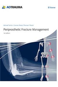 Periprosthetic Fracture Management