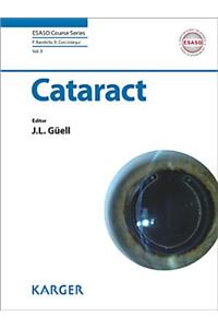 Cataract