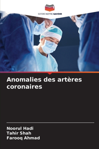 Anomalies des artères coronaires