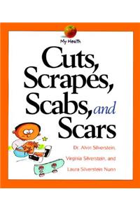 Cuts, Scrapes, Scabs, and Scars