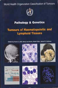 Pathology and genetics of tumours of the haematopoietic and lymphoid tissues: 3 (World Health Organization Classification of Tumours)