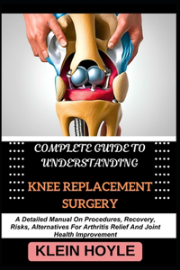 Complete Guide to Understanding Knee Replacement Surgery
