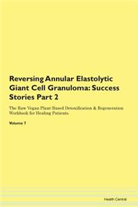 Reversing Annular Elastolytic Giant Cell Granuloma