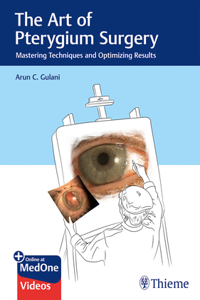 Art of Pterygium Surgery