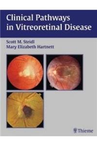 Clinical Pathways in Vitreoretinal Disease
