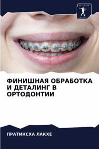 ФИНИШНАЯ ОБРАБОТКА И ДЕТАЛИНГ В ОРТОДОНТИ