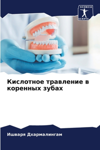 Кислотное травление в коренных зубах