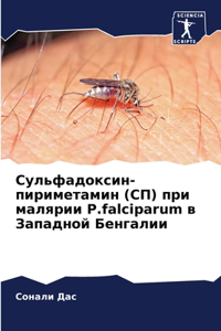 Сульфадоксин-пириметамин (СП) при малярии P.fa