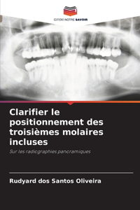 Clarifier le positionnement des troisièmes molaires incluses
