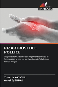 Rizartrosi del Pollice