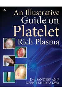 Illustrative Guide on Platelet Rich Plasma