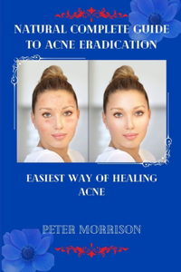 Natural Complete Guide to Acne Eradication