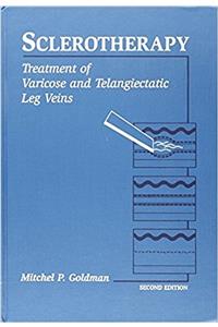 Sclerotherapy: Treatment of Varicose and Telangiectatic Leg Veins