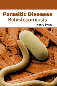 Parasitic Diseases: Schistosomiasis