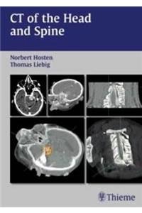 CT of the Head and Spine