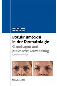 Botulinumtoxin in der Dermatologie