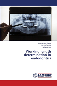 Working length determination in endodontics