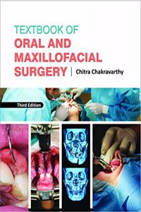 Textbook of Oral and Maxillofacial Surgery