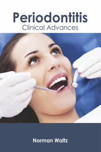 Periodontitis: Clinical Advances