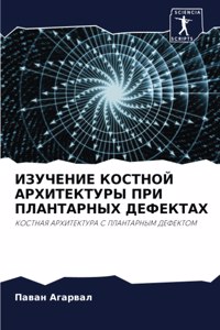 ИЗУЧЕНИЕ КОСТНОЙ АРХИТЕКТУРЫ ПРИ ПЛАНТАР