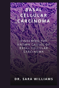 Basal Cellular Carcinoma