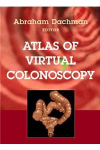 Atlas of Virtual Colonoscopy