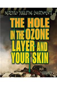 Hole in the Ozone Layer and Your Skin