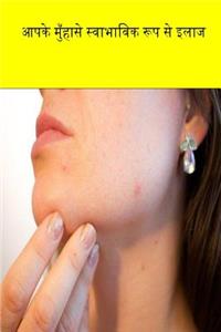 Cure Your Acne Naturally (Hindi)