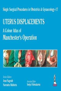 Single Surgical Procedures in Obstetrics and Gynaecology - 17 - UTERUS DISPLACEMENTS
