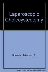 Laparoscopic Cholecystectomy