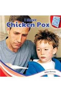 I Have Chicken Pox