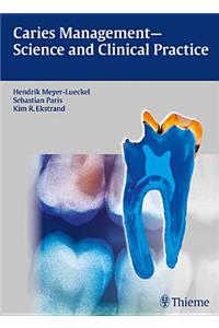 Caries Management - Science and Clinical Practice