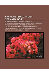 Krankheitsbild in Der Dermatologie
