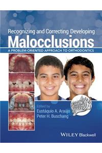 Recognizing and Correcting Developing Malocclusions