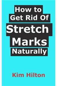 How to Get Rid Of Stretch Marks Naturally