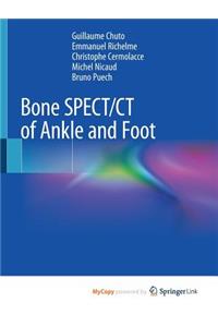 Bone SPECT/CT of Ankle and Foot