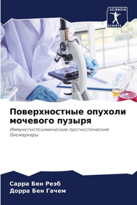 Поверхностные опухоли мочевого пузыря