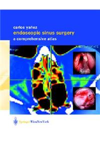 Endoscopic Sinus Surgery