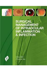 Surgical Management of Intraocular Inflammation and Infection