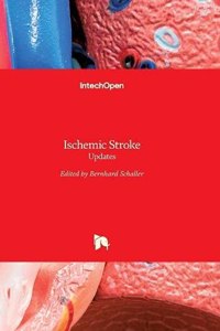 Ischemic Stroke