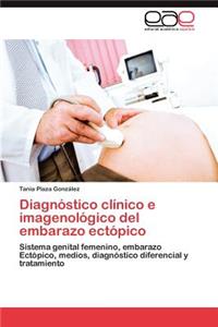 Diagnostico Clinico E Imagenologico del Embarazo Ectopico