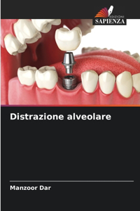 Distrazione alveolare