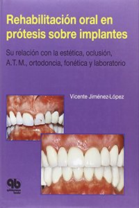 Rehabilitación oral en prótesis sobre implantes