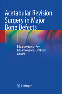 Acetabular Revision Surgery in Major Bone Defects