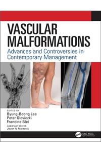 Vascular Malformations