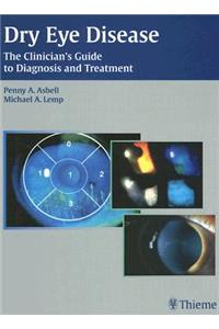 Dry Eye Disease