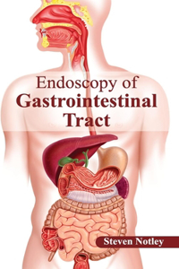 Endoscopy of Gastrointestinal Tract