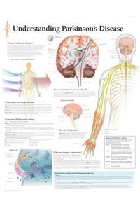 Understanding Parkinson's Laminated Poster