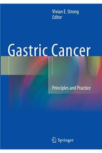 Gastric Cancer